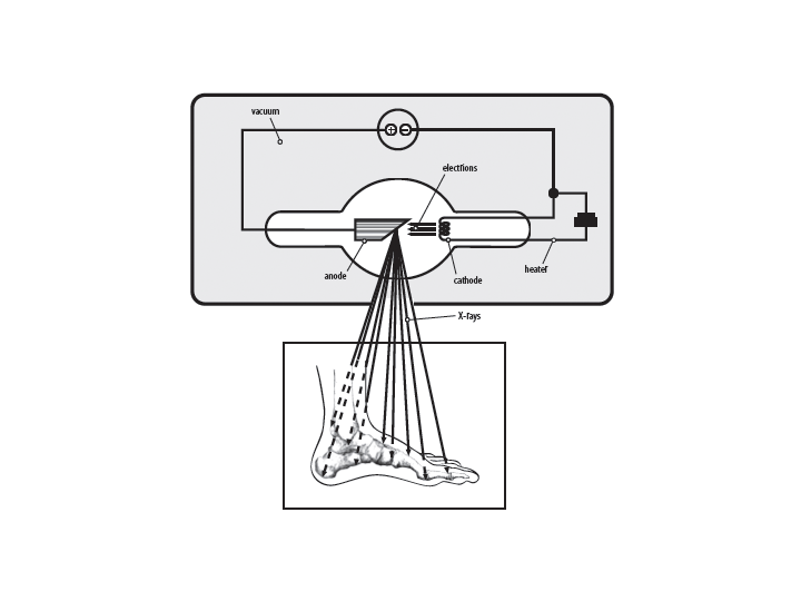 x-ray tube