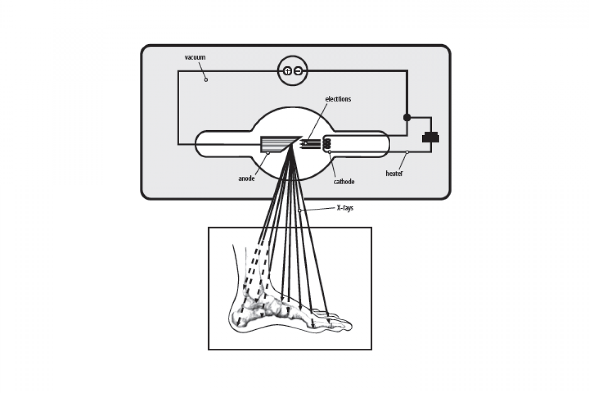 x-ray tube